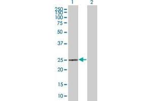 Lane 1: PPP1R1B transfected lysate ( 22. (PPP1R1B 293T Cell Transient Overexpression Lysate(Denatured))