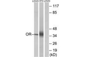 Western blot analysis of extracts from LOVO/NIH-3T3 cells, using OR4D6 Antibody. (OR4D6 anticorps  (AA 260-309))