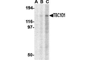 Western Blotting (WB) image for anti-TBC1 (Tre-2/USP6, BUB2, Cdc16) Domain Family, Member 1 (TBC1D1) (C-Term) antibody (ABIN1030722) (TBC1D1 anticorps  (C-Term))