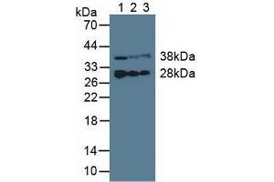 Western blot analysis of (1) Porcine Liver Tissue, (2) Porcine Heart Tissue and (3) Porcine Skeletal Muscle Tissue. (ETFB anticorps  (AA 2-255))