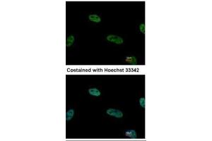 ICC/IF Image Immunofluorescence analysis of paraformaldehyde-fixed HeLa, using TRIP15, antibody at 1:500 dilution. (COPS2 anticorps  (C-Term))
