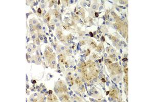 Immunohistochemistry of paraffin-embedded human stomach using MMP9 antibody (ABIN5971121) at dilution of 1/100 (40x lens). (MMP 9 anticorps)