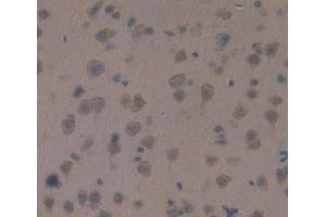 Used in DAB staining on fromalin fixed paraffin- embedded brain tissue (RGS anticorps  (AA 1-296))