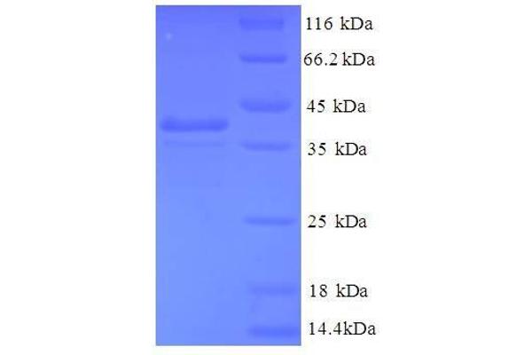 GABARAPL2 Protein (AA 1-117, full length) (GST tag)