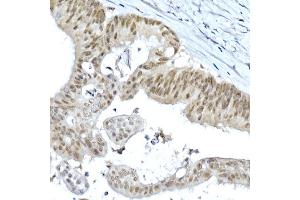 Immunohistochemistry of paraffin-embedded rat ovary using LGR5/GPR49 Rabbit pAb  at dilution of 1:300 (40x lens). (LGR5 anticorps  (AA 824-907))