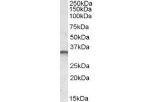 Western Blotting (WB) image for anti-Jun B Proto-Oncogene (JUNB) antibody (ABIN5902460) (JunB anticorps)