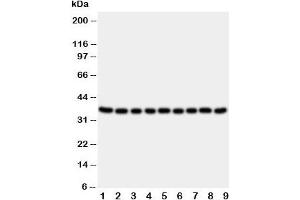 Western blot testing of Kallikrein 10 antibody and Lane 1:  rat ovary;  2: rat testis;  3: rat spleen;  4: rat liver;  5: 22RV;  6: SROV;  7: HeLa;  8: MCF-7;  9: MM231 cell lysate (Kallikrein 10 anticorps  (C-Term))