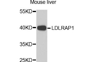 Western blot analysis of extracts of mouse liver, using LDLRAP1 antibody. (LDLRAP1 anticorps)