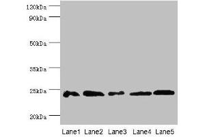 Western blot All lanes: Gstp1 antibody at 2 μg/mL Lane 1: Mouse kidney tissue Lane 2: Jurkat whole cell lysate Lane 3: K562 whole cell lysate Lane 4: 293T whole cell lysate Lane 5: Hela whole cell lysate Secondary Goat polyclonal to rabbit IgG at 1/10000 dilution Predicted band size: 24 kDa Observed band size: 24 kDa (GSTP1 anticorps  (AA 2-210))