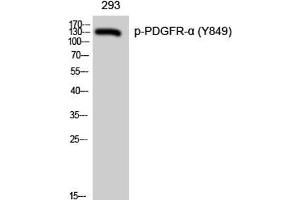 Western Blot analysis of 293 cells with Phospho-PDGFRA (Tyr849) Polyclonal Antibody (PDGFRA anticorps  (pTyr849))