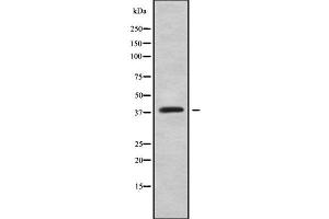 Western blot analysis of HOXC10 using Jurkat whole cell lysates (HOXC10 anticorps  (Internal Region))