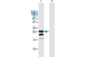 Western Blot analysis of IFNG expression in transfected 293T cell line by IFNG MaxPab polyclonal antibody. (Interferon gamma anticorps  (AA 1-166))