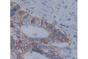 IHC-P analysis of Human Tissue, with DAB staining. (Anoctamin 6 anticorps  (AA 744-824))