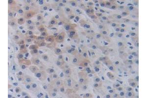 IHC-P analysis of Human Liver Tissue, with DAB staining. (BIRC2 anticorps  (AA 344-593))