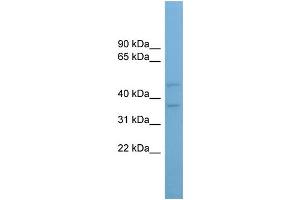 WB Suggested Anti-AADACL4 Antibody Titration: 0. (AADACL4 anticorps  (Middle Region))