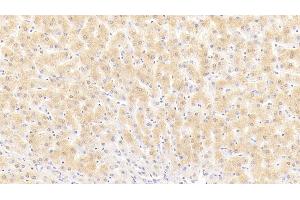 Detection of PSA in Human Liver Tissue using Polyclonal Antibody to Puromycin Sensitive Aminopeptidase (PSA) (NPEPPS anticorps  (AA 584-793))