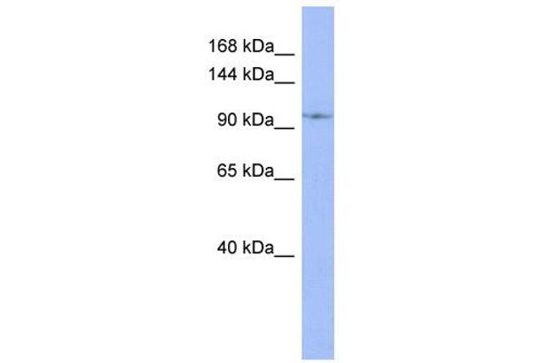 DDX26B anticorps  (N-Term)