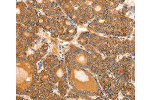 Immunohistochemistry (IHC) image for anti-Secretin (SECR) antibody (ABIN2426879) (Secretin anticorps)