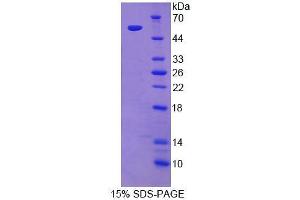 Image no. 1 for 3-Ketodihydrosphingosine Reductase (KDSR) (AA 26-270) protein (His tag,GST tag) (ABIN6239607) (FVT1 Protein (AA 26-270) (His tag,GST tag))