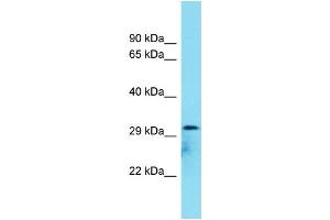 Host: Rabbit Target Name: C8orf74 Sample Type: COLO205 Whole Cell lysates Antibody Dilution: 1. (C8ORF74 anticorps  (C-Term))