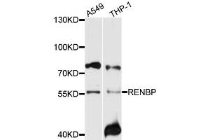 Western blot analysis of extracts of various cell lines, using RENBP antibody (ABIN6003719) at 1/1000 dilution. (RENBP anticorps)