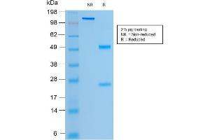 SDS-PAGE Analysis Purified CFTR Mouse Recombinant Monoclonal Antibody (rCFTR/1342). (Recombinant CFTR anticorps)