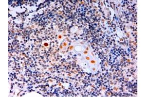 Image no. 2 for anti-Autoimmune Regulator (AIRE) (C-Term) antibody (ABIN374235) (AIRE anticorps  (C-Term))