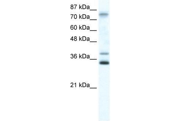 ZNF570 anticorps  (N-Term)