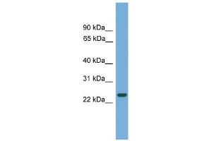 WB Suggested Anti-C19orf18 Antibody Titration: 0. (C19orf18 anticorps  (N-Term))