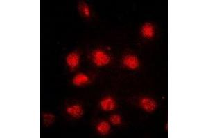 Immunofluorescent analysis of RB1 (pS807) staining in HeLa cells. (Retinoblastoma 1 anticorps  (C-Term, pSer807))
