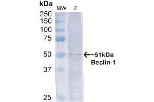 Western blot analysis of Human Cervical cancer cell line (HeLa) lysate showing detection of ~51 kDa Beclin 1 protein using Rabbit Anti-Beclin 1 Polyclonal Antibody (ABIN2868749). (Beclin 1 anticorps  (APC))