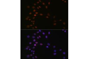 Immunofluorescence analysis of NIH-3T3 cells using L Rabbit mAb (ABIN7270266) at dilution of 1:100 (40x lens). (ASH2L anticorps)