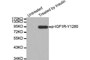 Western blot analysis of extract from 293 cells, using Phospho-IGF1R-Y1280 antibody (ABIN2988067). (IGF1R anticorps  (pTyr1280))