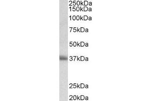 ABIN2561746 (0. (CD7 anticorps  (AA 132-146))