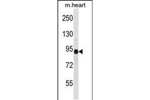 Western blot analysis in mouse heart tissue lysates (35ug/lane). (DTNA anticorps  (C-Term))