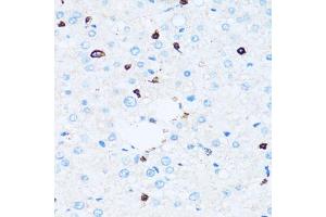 Immunohistochemistry of paraffin-embedded human liver using SPN antibody. (CD43 anticorps)