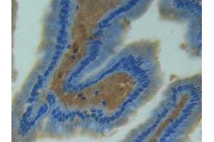 Used in DAB staining on fromalin fixed paraffin- embedded tissue (NOS2 anticorps  (AA 43-213))