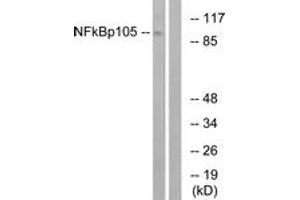 Western Blotting (WB) image for anti-Nuclear Factor of kappa Light Polypeptide Gene Enhancer in B-Cells 1 (NFKB1) (AA 899-948) antibody (ABIN2889032) (NFKB1 anticorps  (AA 899-948))
