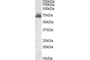 Western Blotting (WB) image for anti-A Kinase (PRKA) Anchor Protein 10 (AKAP10) (AA 28-40) antibody (ABIN290931) (AKAP10 anticorps  (AA 28-40))