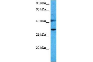 Host:  Mouse  Target Name:  SPRY1  Sample Tissue:  Mouse Liver  Antibody Dilution:  1ug/ml (SPRY1 anticorps  (N-Term))