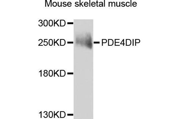 PDE4DIP anticorps