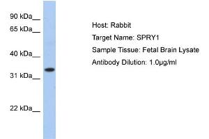 WB Suggested Anti-SPRY1 Antibody Titration:  0. (SPRY1 anticorps  (N-Term))