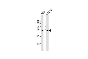 All lanes : Anti-mouse BAD Antibody at 1:1000 dilution Lane 1: A20 whole cell lysate Lane 2: C2C12 whole cell lysate Lysates/proteins at 20 μg per lane. (BAD anticorps  (AA 90-118))