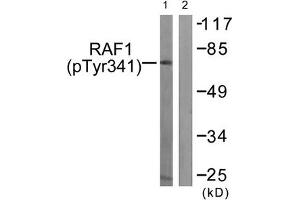 Western blot analysis of extracts from Jurkat cells treated with Paclitaxel using Raf1 (Phospho-Tyr341) Antibody. (RAF1 anticorps  (pTyr341))