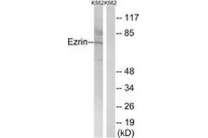 Western Blotting (WB) image for anti-Ezrin (EZR) (AA 446-495) antibody (ABIN2889087) (Ezrin anticorps  (AA 446-495))
