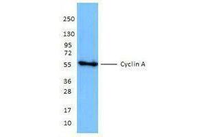 Western Blotting (WB) image for anti-Cyclin A2 (CCNA2) antibody (ABIN2664910) (Cyclin A anticorps)