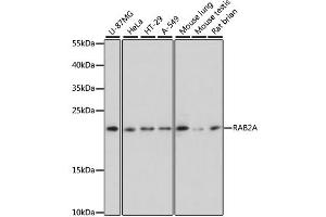 Western blot analysis of extracts of various cell lines, using RAB2A antibody. (RAB2A anticorps)
