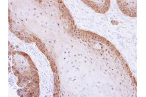 IHC-P Image Immunohistochemical analysis of paraffin-embedded Cal27 xenograft, using XBP1, antibody at 1:500 dilution. (XBP1 anticorps)