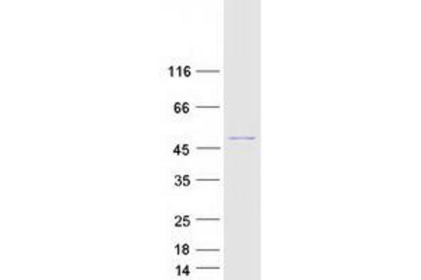 BCS1L Protein (Transcript Variant 1) (Myc-DYKDDDDK Tag)