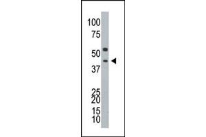 Image no. 1 for anti-Ataxin 3 (ATXN3) (N-Term) antibody (ABIN357621) (Ataxin 3 anticorps  (N-Term))